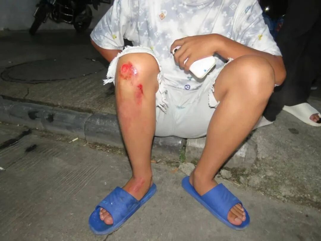 14岁骑车带人撞上半挂车,这些未成年人事故案例要警惕